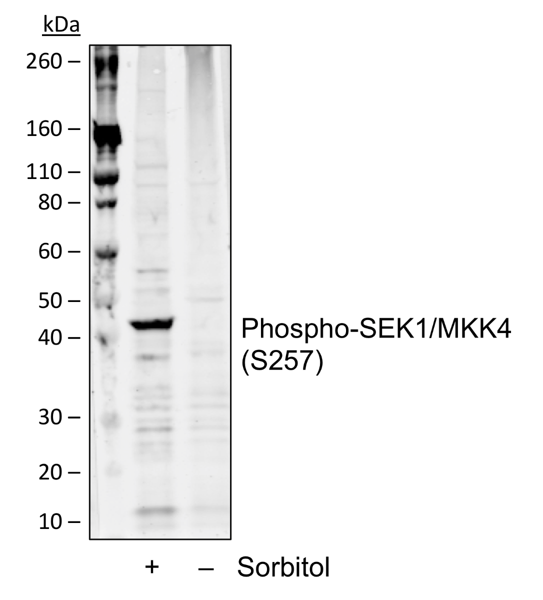 Phospho-SEK1/MKK4 (Ser257) (C5) rabbit mAb Antibody