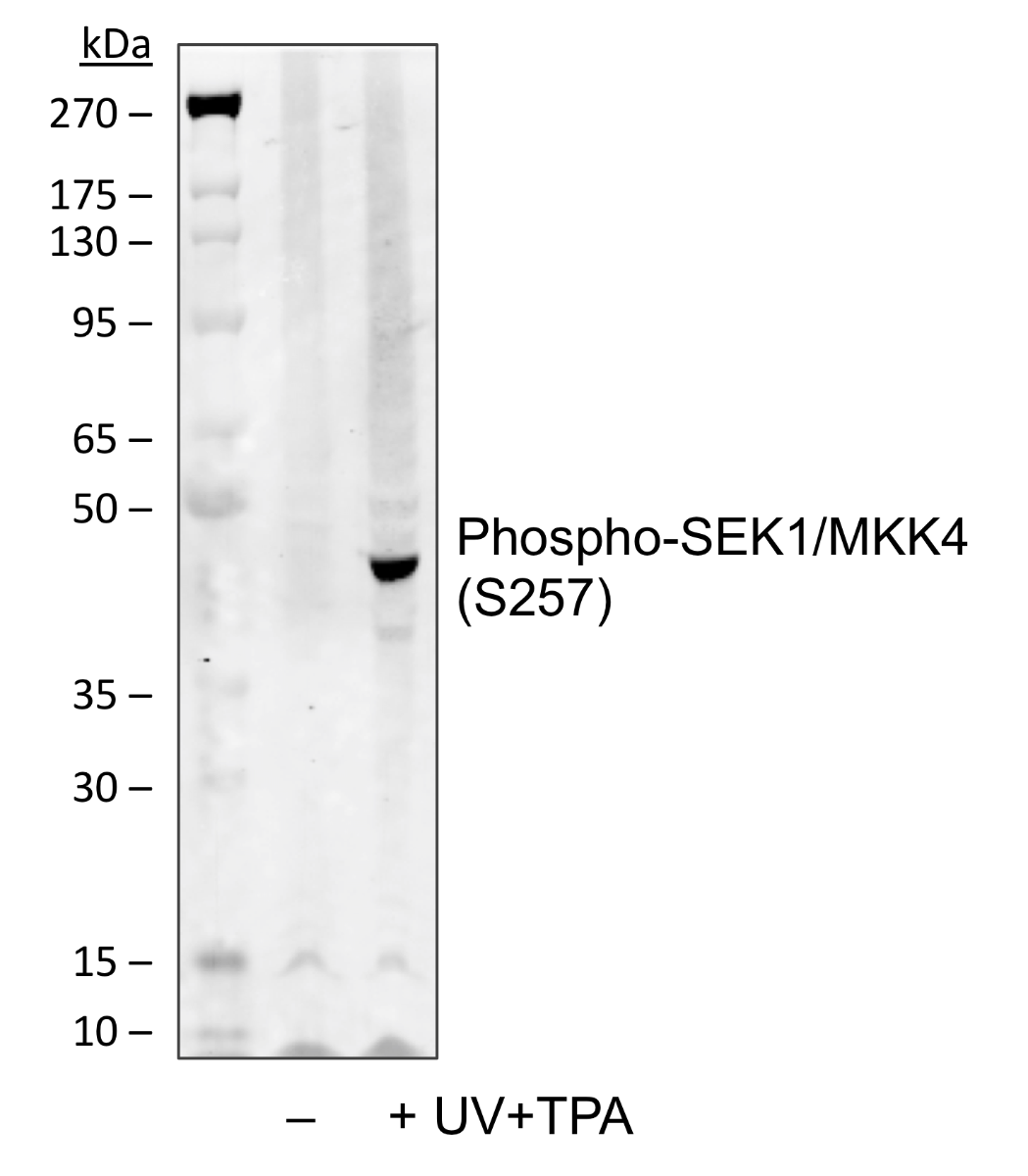 Phospho-SEK1/MKK4 (Ser257) (C5) rabbit mAb Antibody
