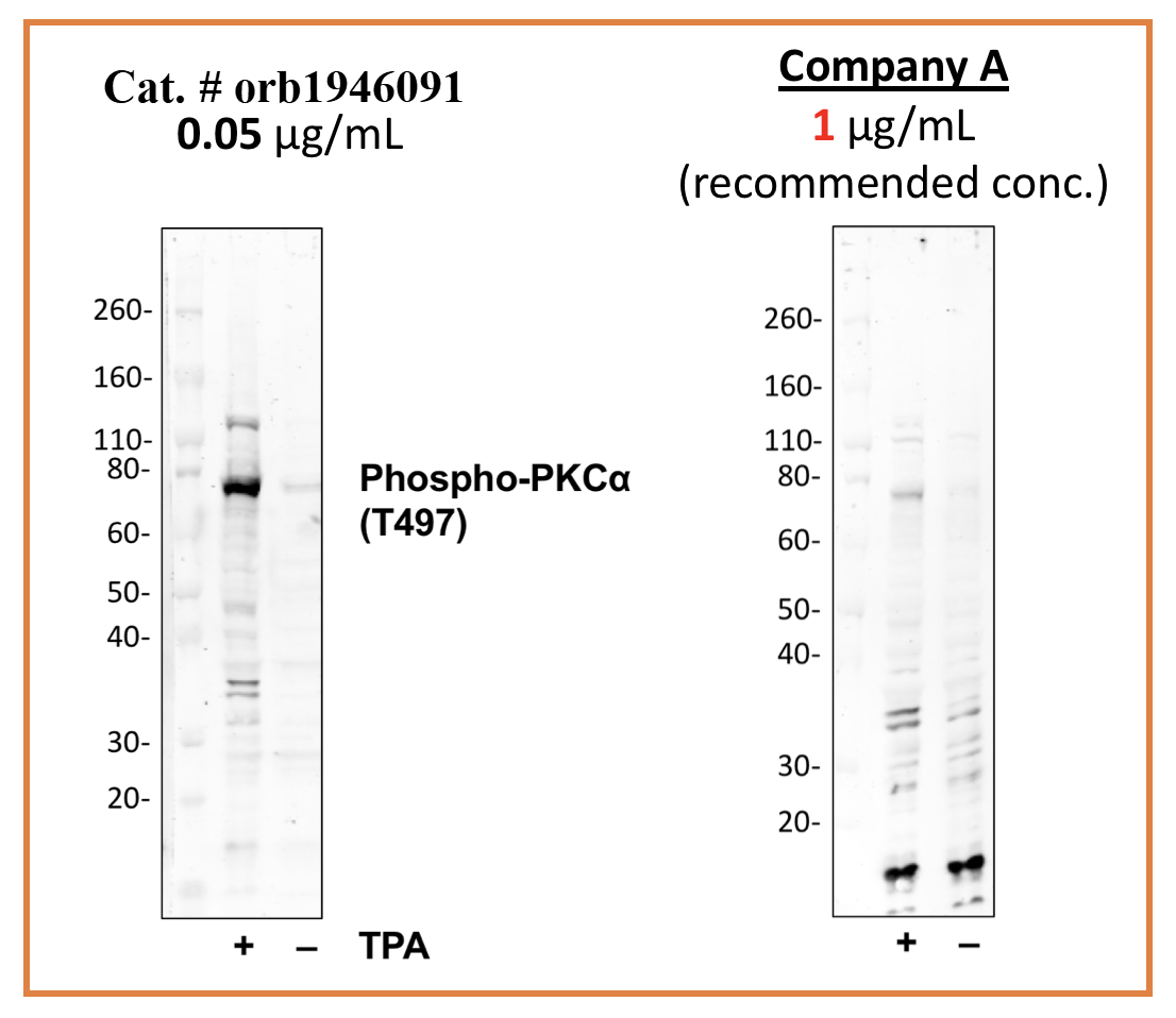 Phospho-PKCa (Thr497) (F1) rabbit mAb Antibody