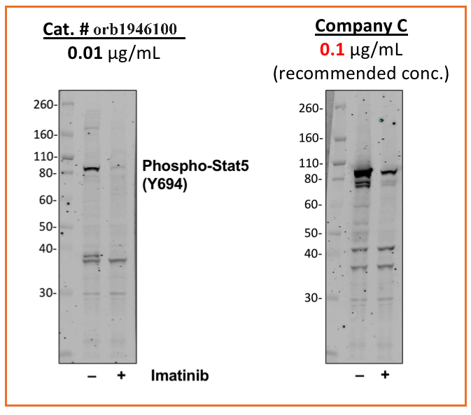 Phospho-Stat5 (Tyr694) (G11) rabbit mAb