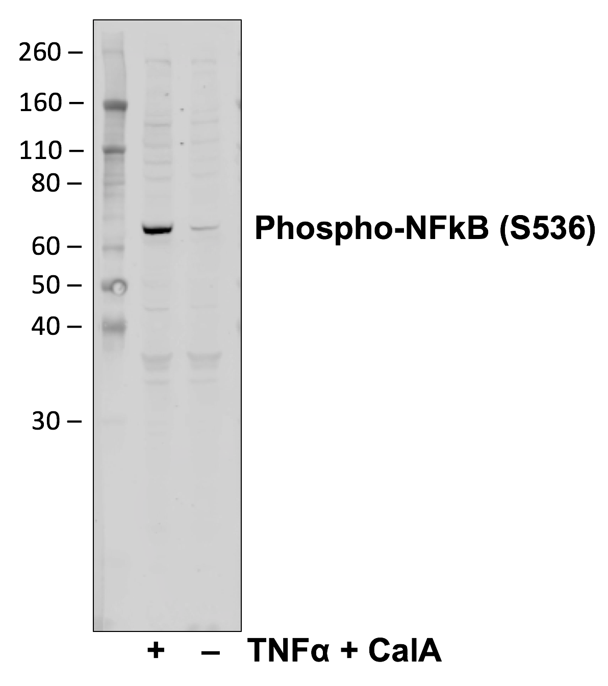 Phospho-NFkB p65 (Ser536) rabbit mAb Antibody