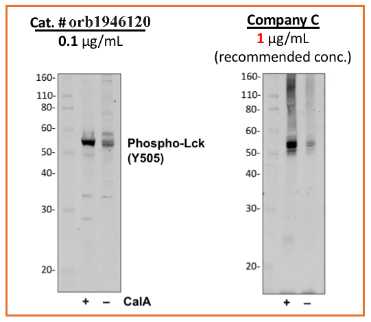 Phospho-Lck (Tyr505) (A3) rabbit mAb Antibody