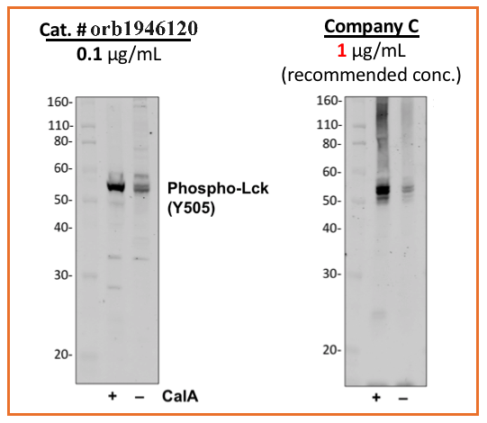 Phospho-Lck (Tyr505) (A3) rabbit mAb