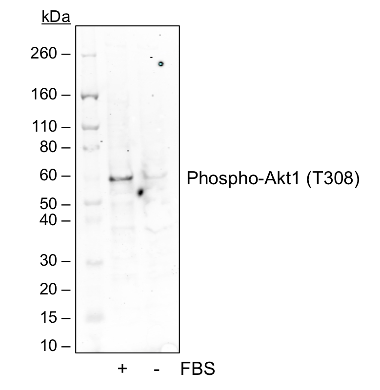 Phospho-Akt1 (Thr308) (G12) rabbit mAb Antibody
