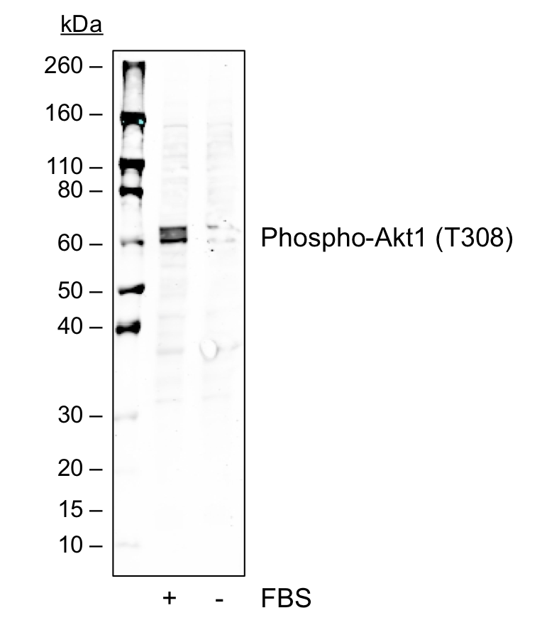 Phospho-Akt1 (Thr308) (G12) rabbit mAb