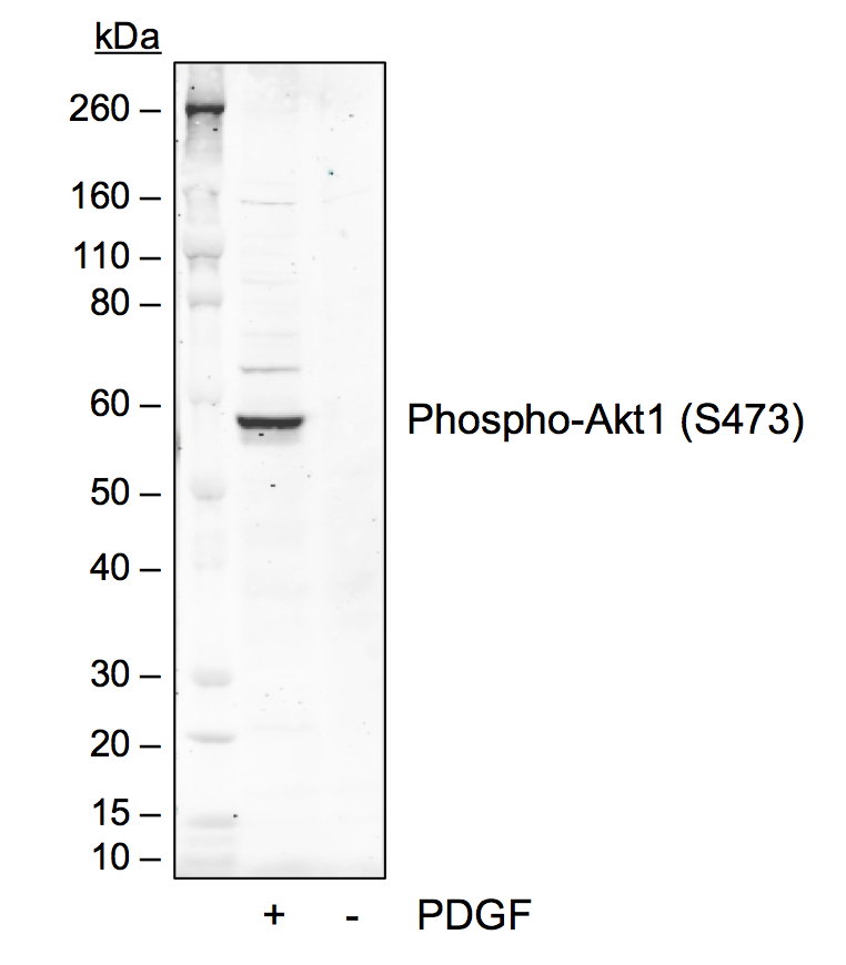 Phospho-Akt1 (Ser473) (B9) rabbit mAb