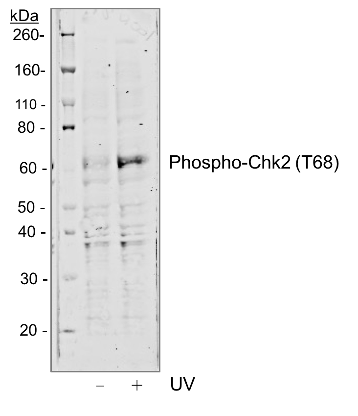 Phospho-Chk2 (Thr68) (D12) rabbit mAb Antibody