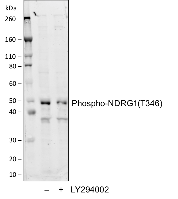 Phospho-NDRG1 (Thr346) (F5) rabbit mAb Antibody