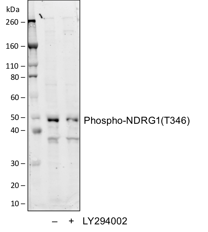 Phospho-NDRG1 (Thr346) (F5) rabbit mAb