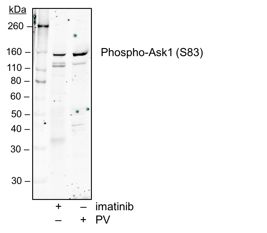 Phospho-Ask1 (Ser83) (G4) rabbit mAb Antibody