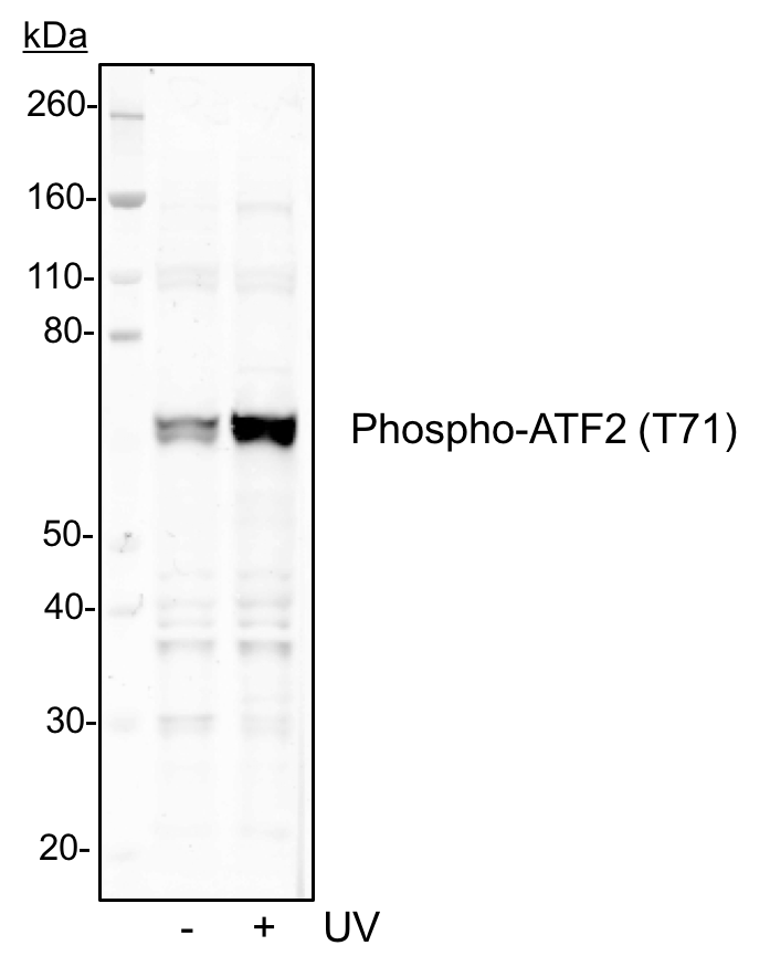 Phospho-ATF2 (Thr71) (G3) rabbit mAb Antibody