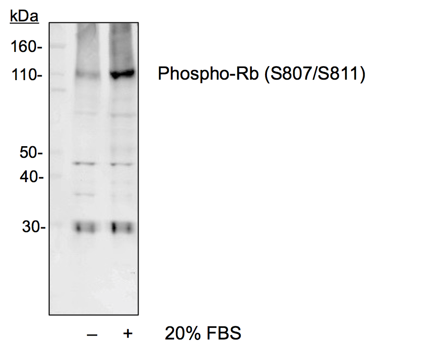 Phospho-Rb (Ser807/811) (D9) rabbit mAb Antibody