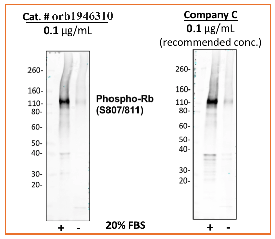 Phospho-Rb (Ser807/811) rabbit mAb Antibody