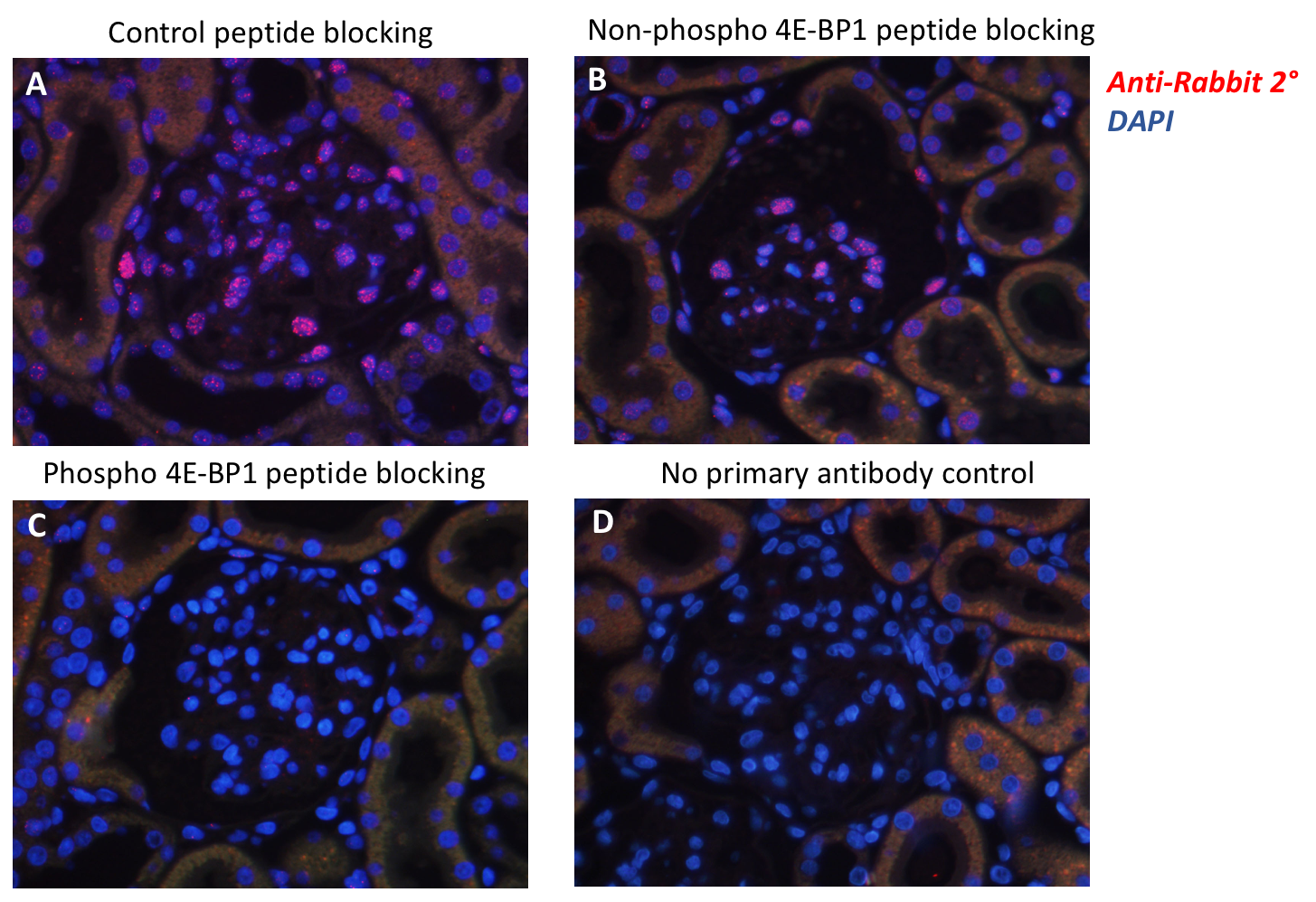 Phospho-4E-BP1 (Thr37/46) (A5) rabbit mAb