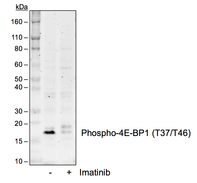 Phospho-4E-BP1 (Thr37/46) (A5) rabbit mAb Antibody