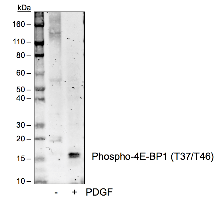 Phospho-4E-BP1 (Thr37/46) (A5) rabbit mAb Antibody
