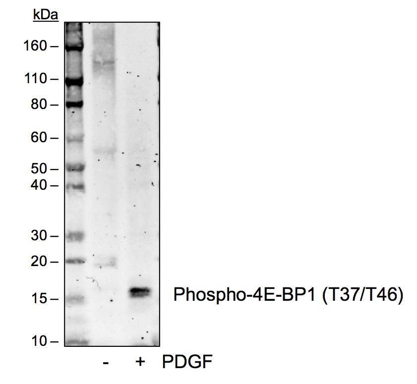 Phospho-4E-BP1 (Thr37/46) (A5) rabbit mAb