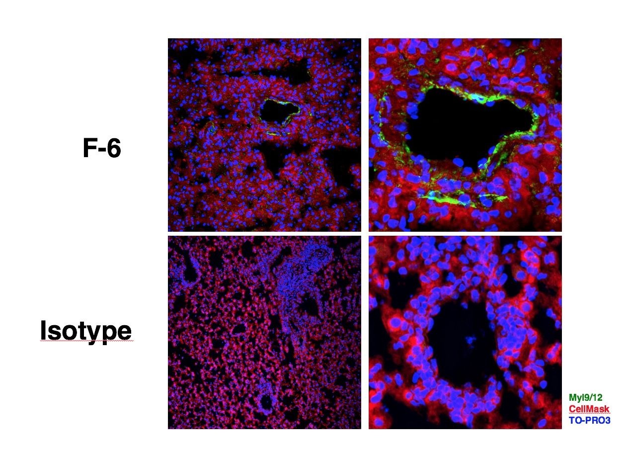 Human/Mouse Myl9/12 (F6) rabbit mAb Antibody