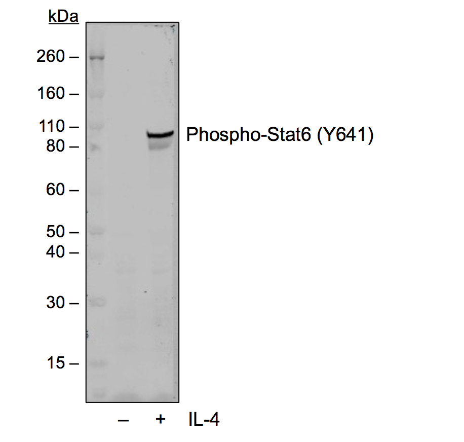 Phospho-Stat6 (Tyr641) (G12) rabbit mAb