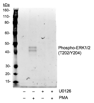 Phospho-p44/42 MAPK (Erk1/2) (Thr202/Tyr204) (A11) rabbit mAb Antibody
