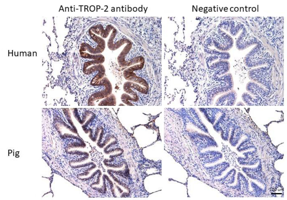 TROP2 Antibody