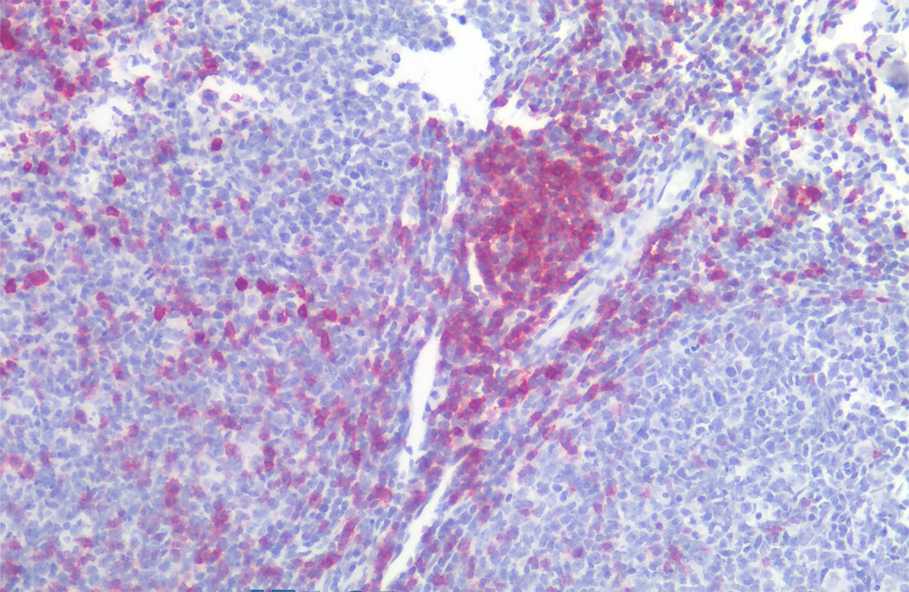 Anti-Hu CD5 Purified