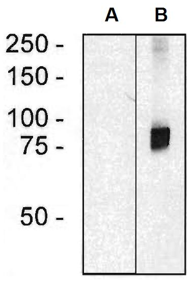 ARHGEF4 Antibody