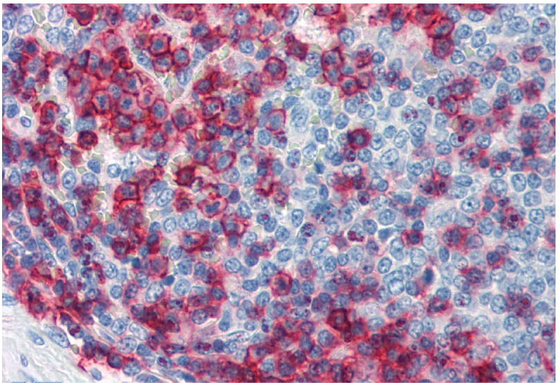 Anti-Hu CD43 Purified Low Endotoxin