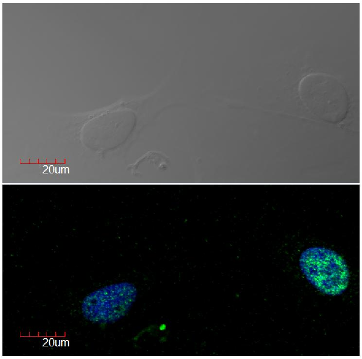 Ki-67 antibody