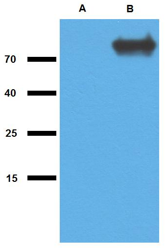 GlcB (M. tuberculosis) Antibody