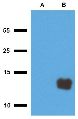Tb10.3 (M. tuberculosis) Antibody