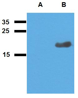 Acr2 (M. tuberculosis) Antibody