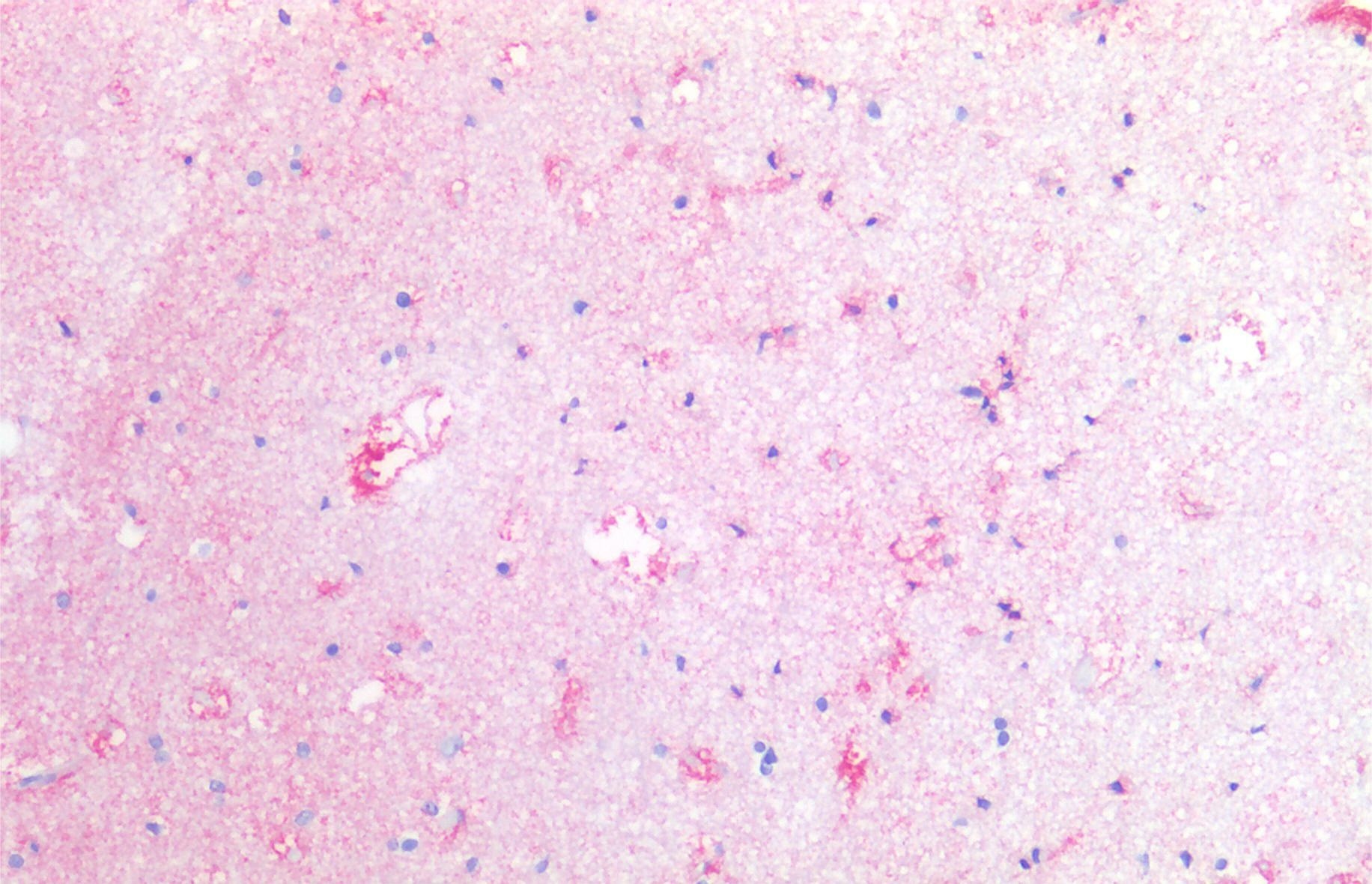 Anti-Hu CD142 Purified