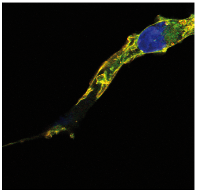 TC21 antibody