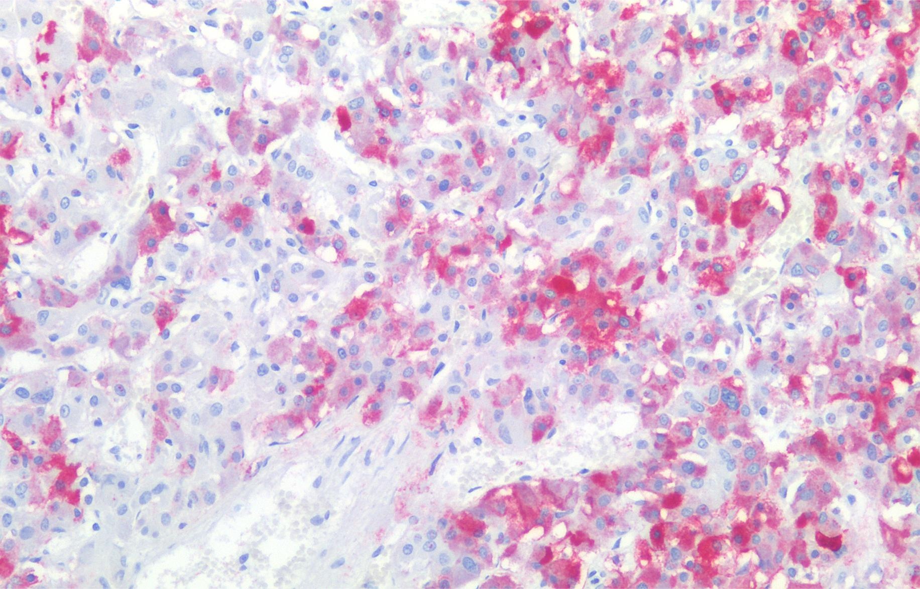CD57 Antibody