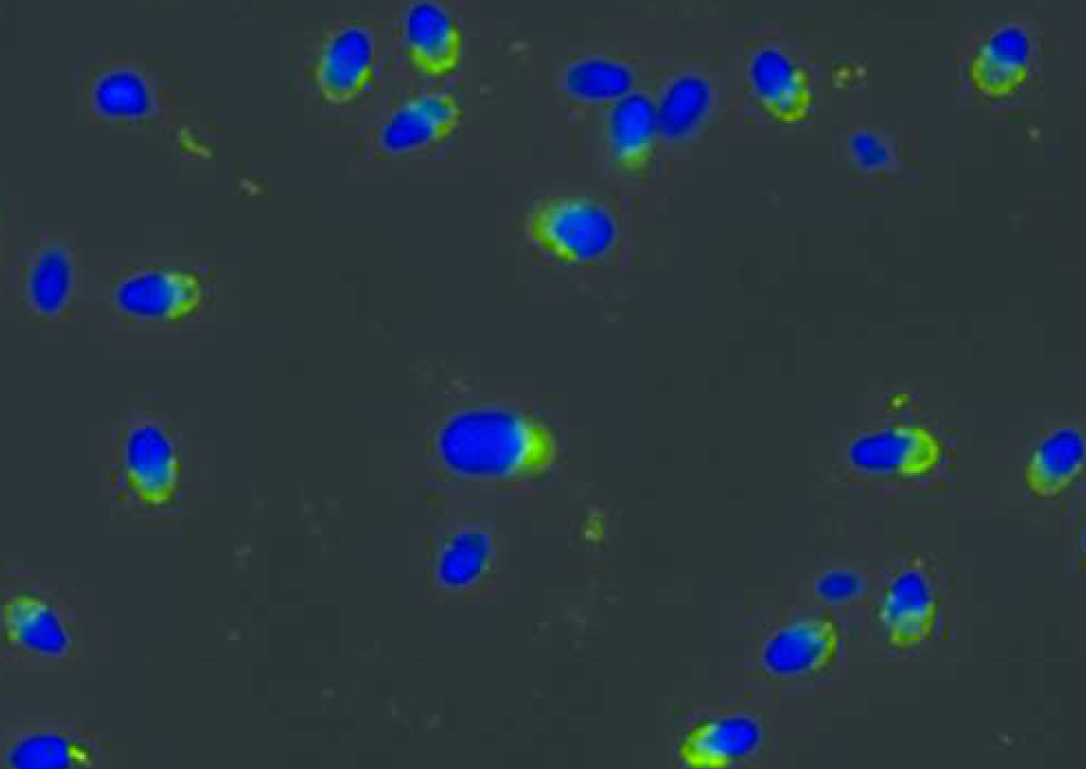 PRKAR2A Antibody