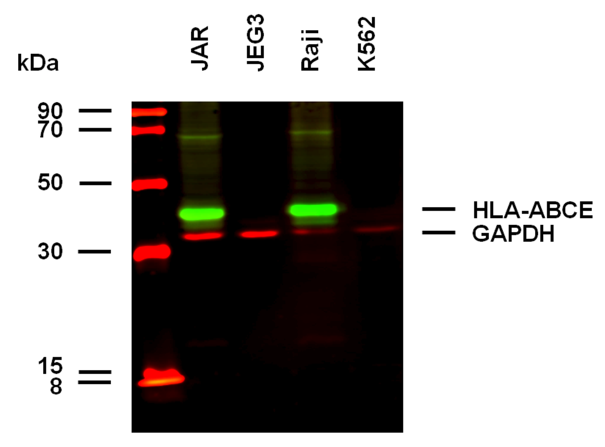 HLA-A+B+C+E antibody