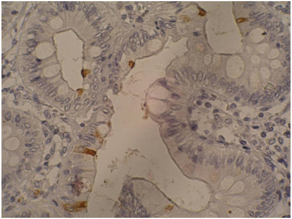 Sialyl Lewis a Antibody