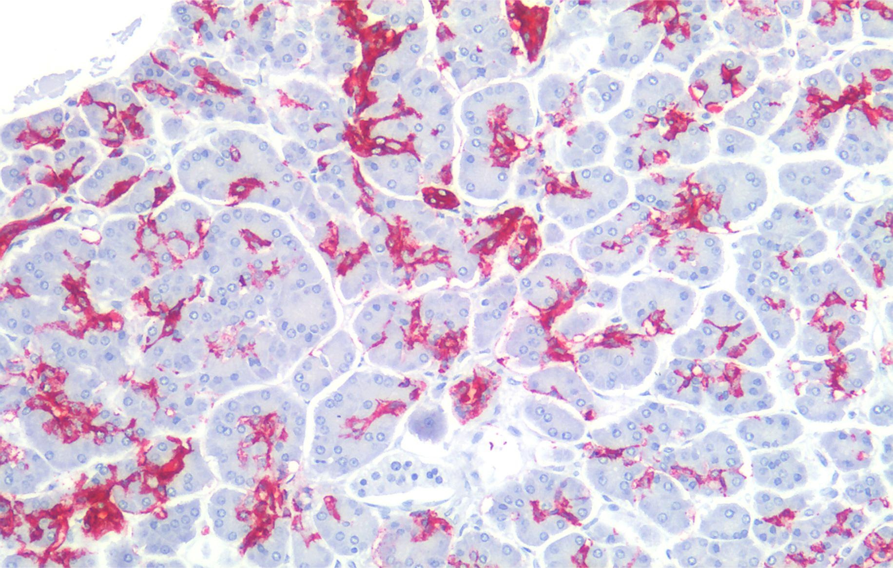 Sialyl Lewis a Antibody