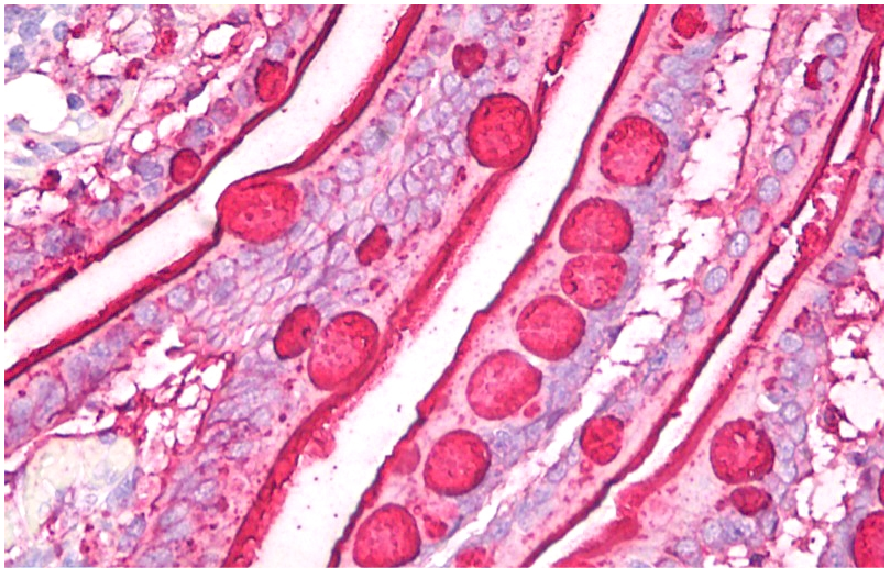 Blood Group Lewis b Antibody
