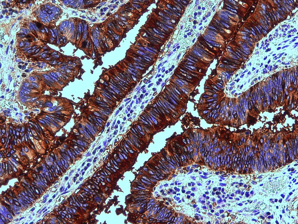 Blood Group Lewis b Antibody
