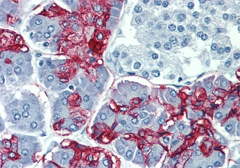 Blood Group Lewis a antibody