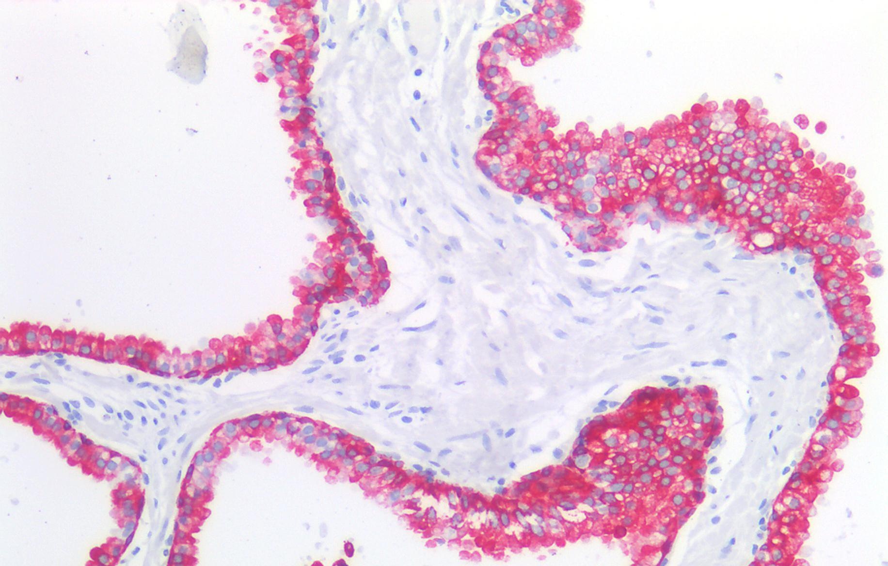 Anti-Cytokeratin 19 Purified