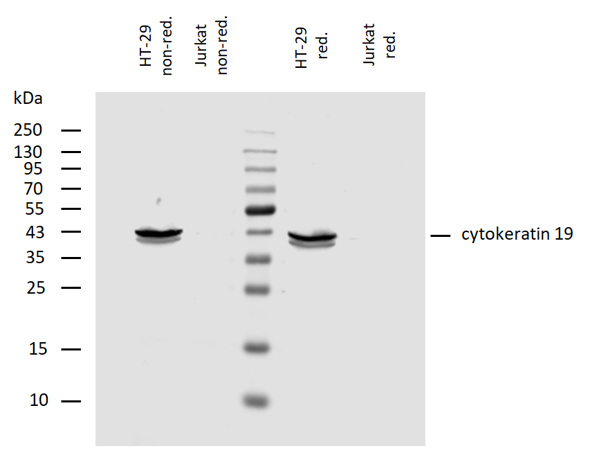 Anti-Cytokeratin 19 Purified