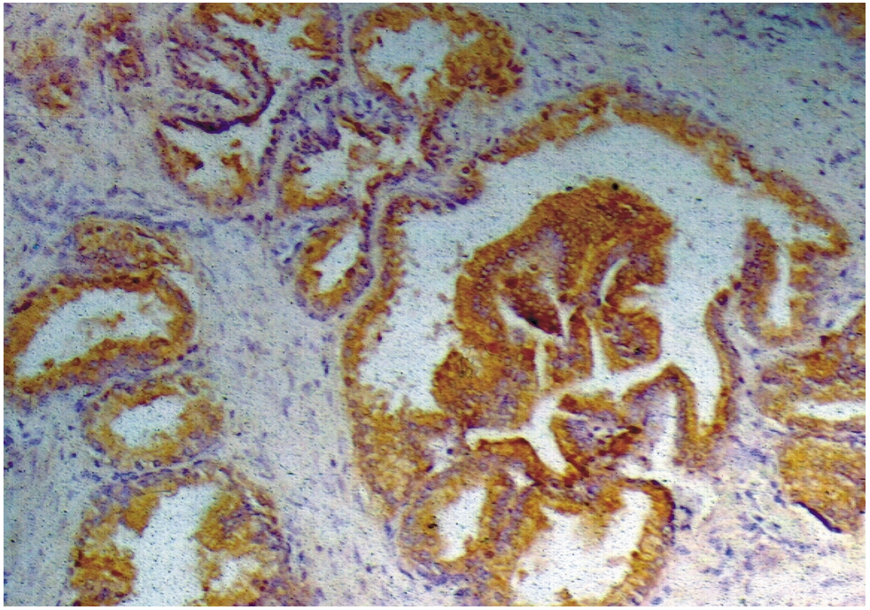 PSA Antibody