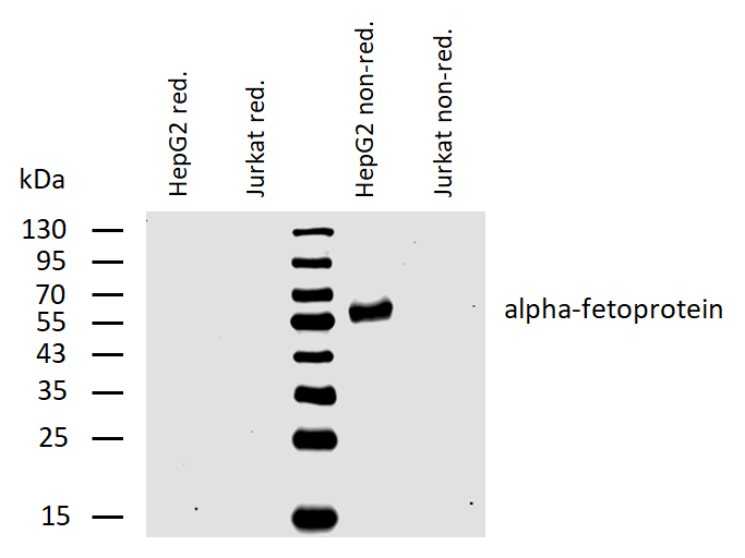 alpha-Fetoprotein Antibody