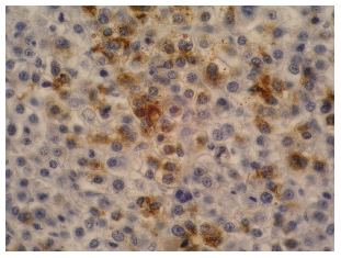 alpha-Fetoprotein Antibody