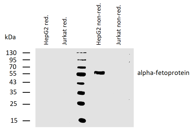 alpha-Fetoprotein Antibody