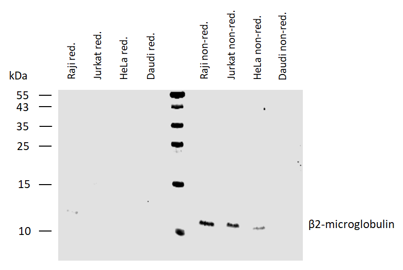 beta2-Microglobulin Antibody (Biotin)