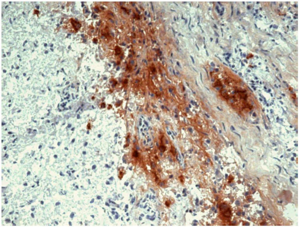 beta-Endorphin Antibody